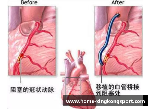 球员筋膜炎：症状、治疗与预防